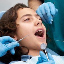 A Perfect Guide on Sealants for Kids – Lakefront Smiles